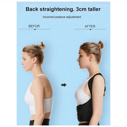 Adjustable Unisex Breathable Back Posture Corrector Brace